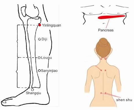 diabetic foot treatment