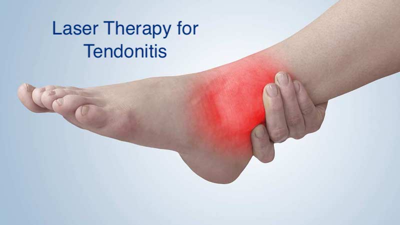 Laser therapy for tendonitis