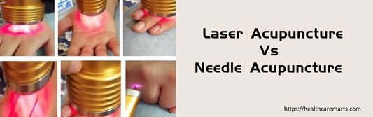Laser Acupuncture Vs. Needle Acupuncture
