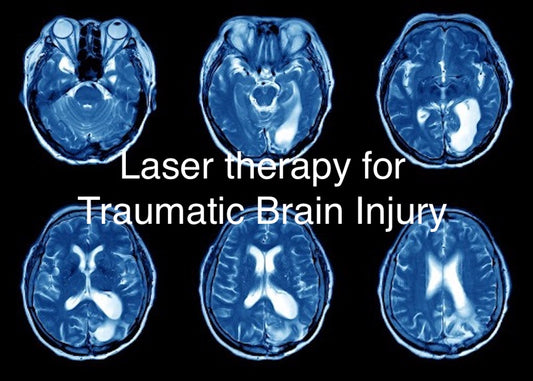 Laser therapy for brain injury