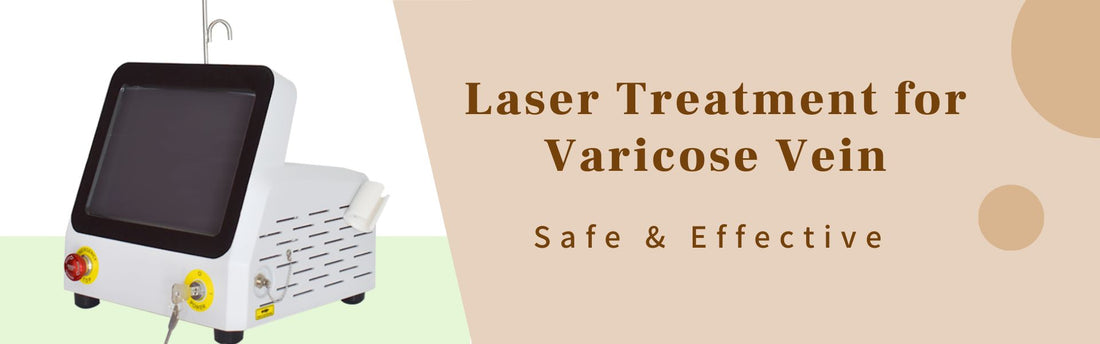 Laser Treatment for varicose vein
