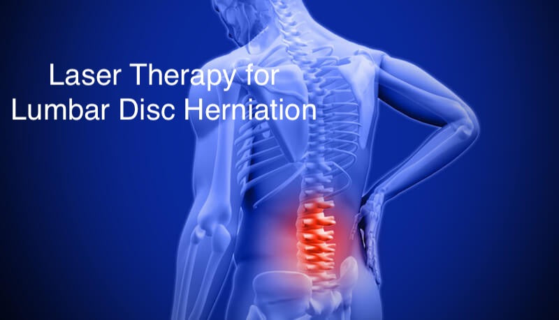 What is the Best Way to Treat Lumbar disc herniation