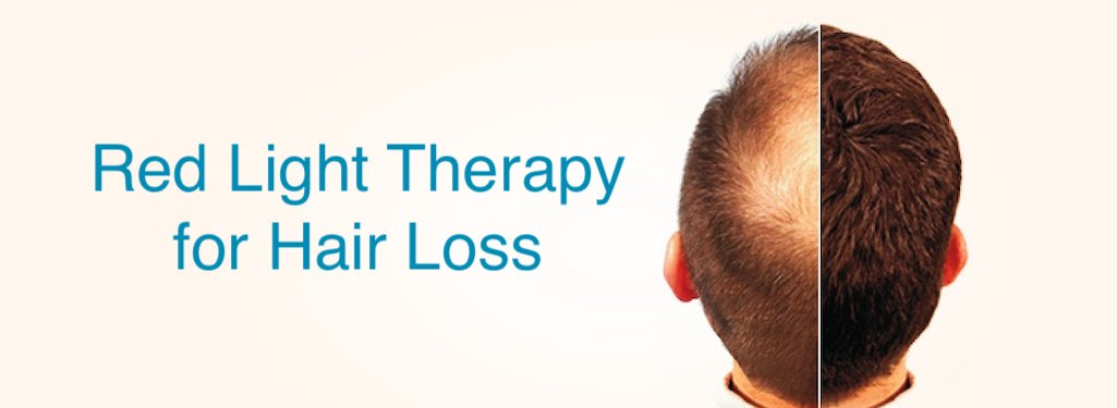 Red light therapy for hair loss