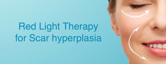 Red light therapy for scars hyperplasia