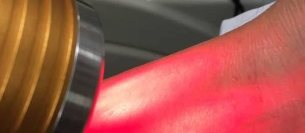 Cold Laser Therapy Reviews - Accidental injury