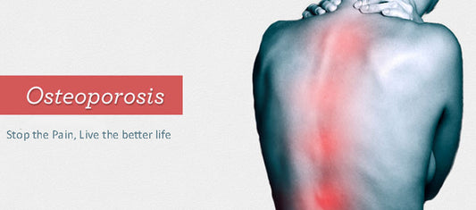 The Best Way for the Osteoporosis Treatment